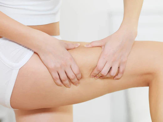 Schwere Beine im Sommer? Die besten Tipps gegen Schwellungen und Wasseransammlungen